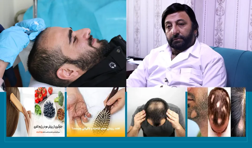 Mental pressure main factor behind hair loss – GudMag