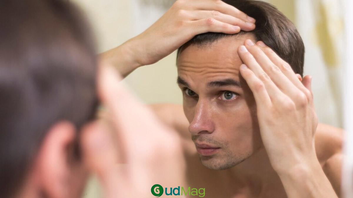 Hair Loss Woes: Common Reasons Why Men Under 25 Experience Baldness And How To Stop It – GudMag